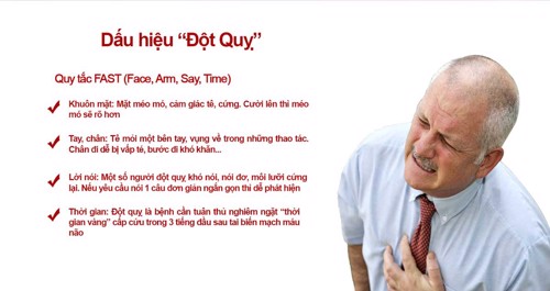 Bị đau đầu, choáng váng, chân tay tê cứng,... có phải dấu hiệu đột quỵ không và phải làm sao?