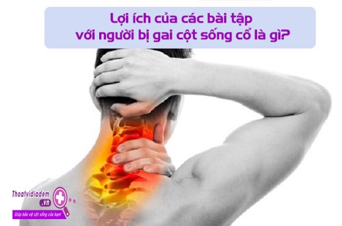 Bị gai cột sống cổ - Áp dụng ngay các bài tập này! 