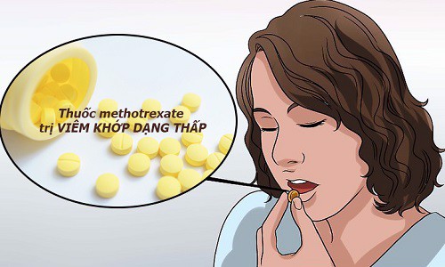 Thuốc điều trị viêm khớp dạng thấp methotrexate và những lưu ý khi sử dụng
