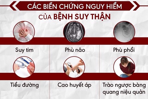 Những biến chứng của suy thận là gì? Ảnh hưởng đến sức khỏe như thế nào?