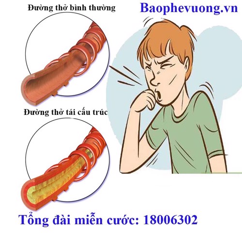 XEM NGAY các món ăn trị ho có đờm cho người lớn TẠI ĐÂY!