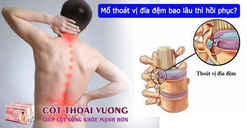 Mổ thoát vị đĩa đệm bao lâu thì hồi phục? 