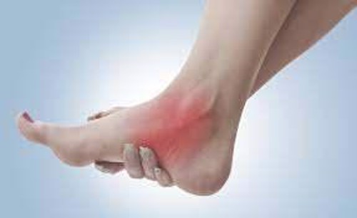 Viêm khớp mắt cá chân và những điều cần lưu ý