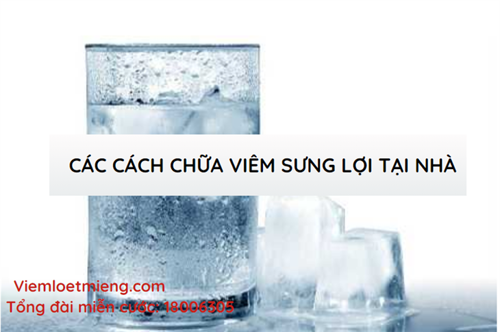 Các cách chữa viêm sưng lợi ở nhà. Xem ngay dưới đây!