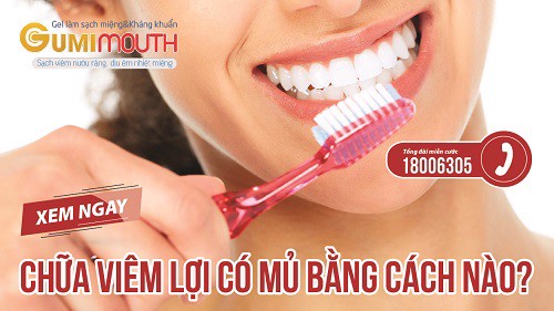 Chữa viêm lợi có mủ bằng cách nào? XEM NGAY thông tin tại đây