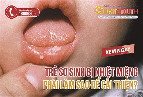 Trẻ sơ sinh bị nhiệt miệng phải làm sao để cải thiện? Xem ngay