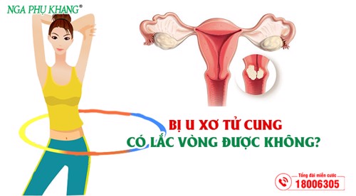 Bị u xơ tử cung có lắc vòng được không? Giải đáp thắc mắc TẠI ĐÂY