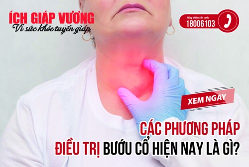 Các phương pháp điều trị bướu cổ hiện nay là gì? Tại sao nên dùng giải pháp từ thảo dược để cải thiện?