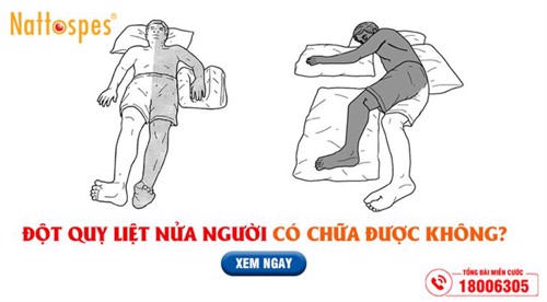 Đột quỵ liệt nửa người có chữa được không? – Cách phục hồi hiệu quả nhờ sản phẩm thiên nhiên