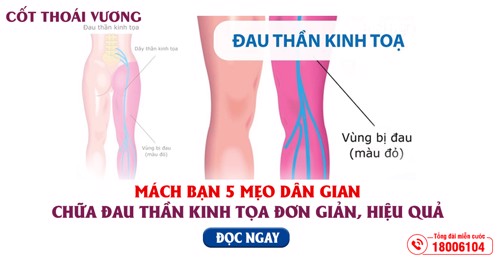 Mách bạn 5 mẹo dân gian chữa đau thần kinh tọa CỰC TỐT ai cũng cần biết