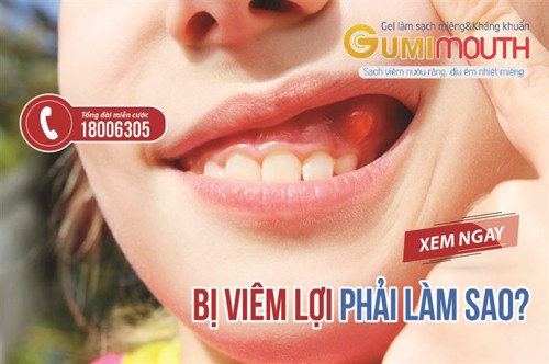 Bị viêm lợi phải làm sao? Xem ngay cách cải thiện hiệu quả từ thảo dược