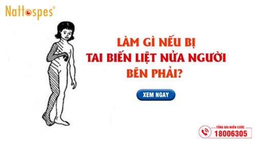 Làm gì nếu bị tai biến liệt nửa người bên phải? – Xem ngay cách cải thiện nhờ sản phẩm thiên nhiên