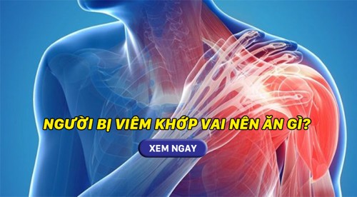 Giải đáp thắc mắc: Người bị viêm khớp vai nên ăn gì? Câu trả lời sẽ có Ở ĐÂY!