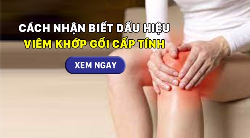 Cách nhận biết dấu hiệu viêm khớp gối cấp tính. XEM NGAY TẠI ĐÂY!