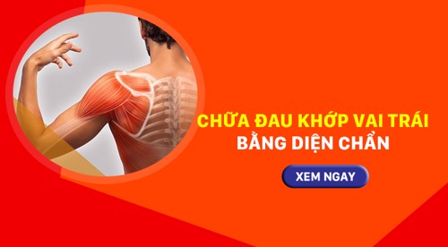  Cách chữa đau khớp vai trái bằng diện chẩn. XEM NGAY KẺO LỠ!