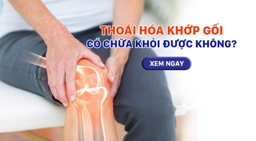 Thoái hóa khớp gối có chữa khỏi được không và cách cải thiện hiệu quả từ thiên nhiên