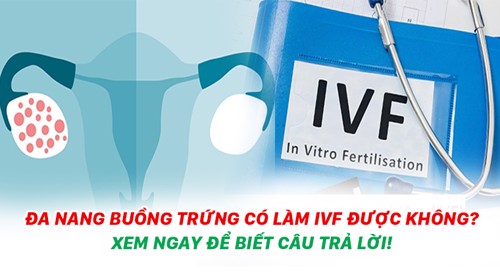 Đa nang buồng trứng có làm ivf được không? Xem ngay để biết câu trả lời!