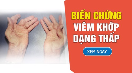 Biến chứng viêm khớp dạng thấp thường gặp và giải pháp cải thiện từ thiên nhiên