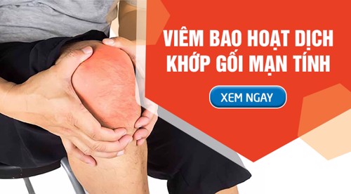 Viêm bao hoạt dịch khớp gối mạn tính: Triệu chứng và cách cải thiện từ thảo dược