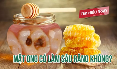 Mật ong có làm sâu răng không? TÌM HIỂU NGAY!