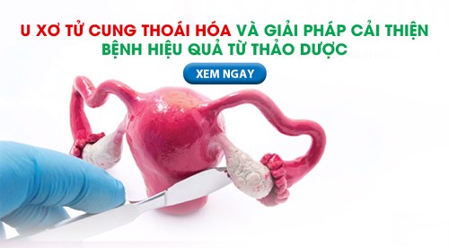 U xơ tử cung thoái hóa và giải pháp cải thiện bệnh hiệu quả từ thảo dược