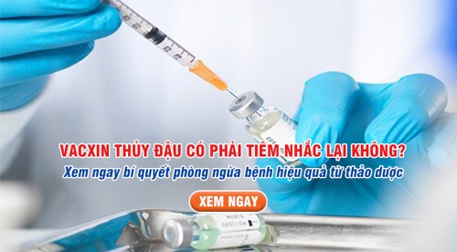 Vacxin thủy đậu có phải tiêm nhắc lại không? Xem ngay bí quyết phòng ngừa bệnh hiệu quả từ thảo dược