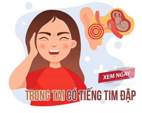  Nghe thấy trong tai có tiếng tim đập, phải làm sao để cải thiện?