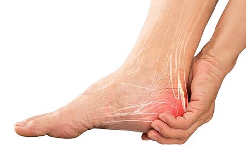 Bị đau gót chân đã tiêm, uống thuốc tây, châm cứu không đỡ cần làm cách nào để giảm đau?