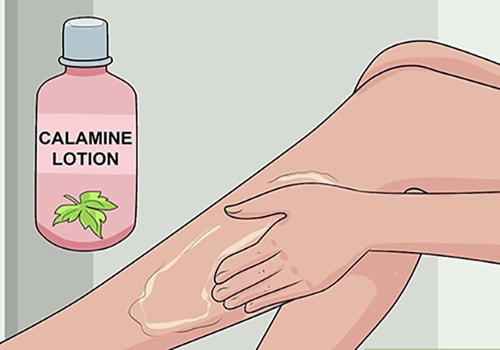 dung-dịch-calamine-giúp-giảm-ngứa-sau-khi-tắm