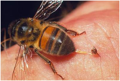 Điều trị bệnh Parkinson bằng châm cứu nọc ong