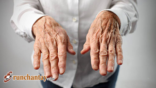 Nguyên nhân run tay chân ở người già và cách chữa trị