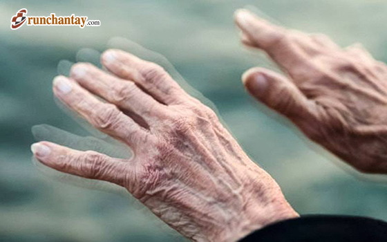Run tay do bệnh Parkinson: Cách giảm run hiệu quả bạn cần biết