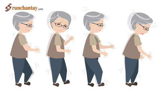 Hiểu đúng về các giai đoạn của bệnh Parkinson