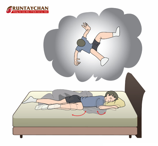 Rung giật cơ khi ngủ gây cảm giác hụt chân, rơi xuống vực