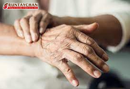 Thuốc Syndopa 275 giúp cải thiện triệu chứng vận động của bệnh Parkinson