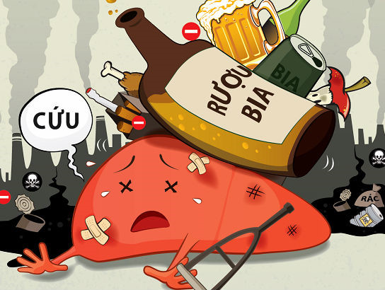 Uống bia rượu nhiều nguy cơ gây bệnh gan