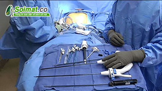 Phẫu thuật cắt túi mật nội soi thường được chỉ định trong điều trị viêm túi mật