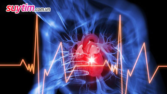 Suy tim nhẹ cũng có thể dẫn đến ngưng tim đột ngột