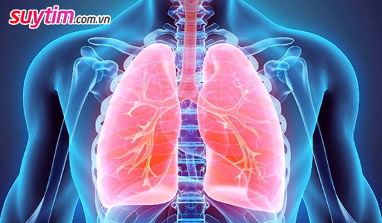 Phù phổi cấp là biến chứng thường gặp khi suy tim trở  nặng