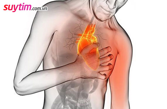 Người bệnh mạch vành có thể có chỉ định đặt stent khi có cơn đau thắt ngực không ổn định