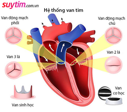 Hở van tim ¼ có sao không tùy theo loại van và mức độ triệu chứng