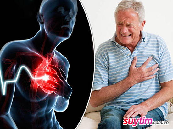  Triệu chứng đau tim cảnh báo tình trạng thiếu máu cơ tim, bệnh mạch vành
