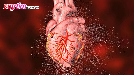 6 cách phân loại và phân độ suy tim bạn cần biết