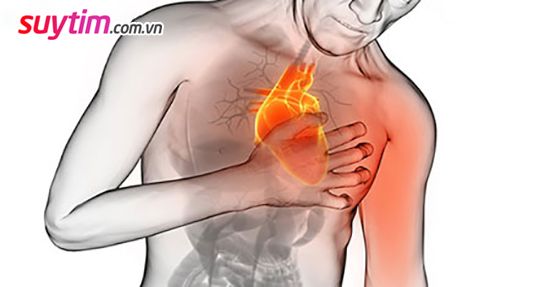 Điểm danh các triệu chứng suy tim thường gặp nhất