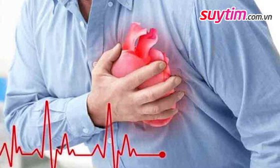 Điều trị nhồi máu cơ tim cần được tiến hành càng sớm càng tốt.