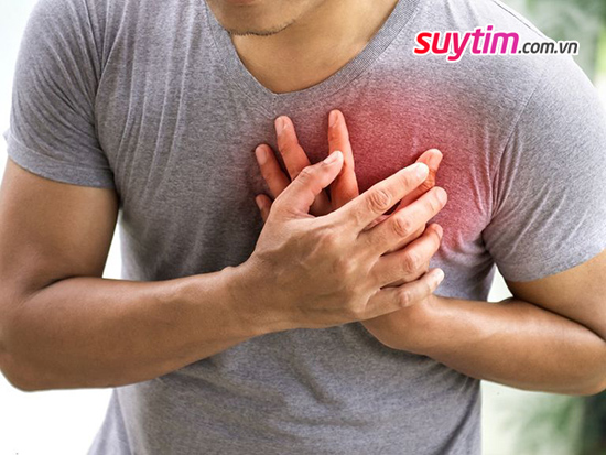 Nhồi máu cơ tim cần phòng ngừa sớm, giảm nguy cơ tử vong