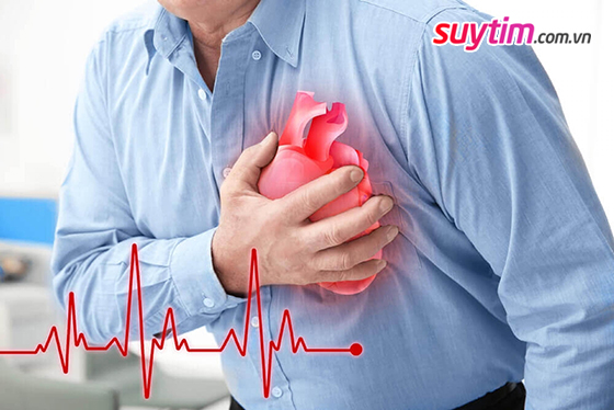 Bệnh phì đại cơ tim có thể dẫn đến biến chứng suy tim, rối loạn nhịp nguy hiểm