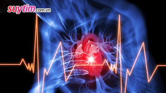 Người bệnh cơ tim hạn chế có thể bị đột tử vì rối loạn nhịp tim hoặc nhồi máu cơ tim