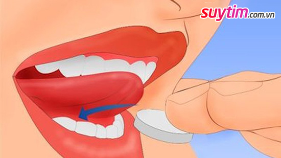 Đặt Nitroglycerin ở dưới lưỡi ngay khi có dấu hiệu của cơn đau thắt ngực