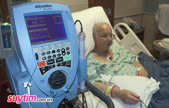 Liệu pháp aquapheresis giúp giảm sưng phù ở người bệnh suy tim sung huyết